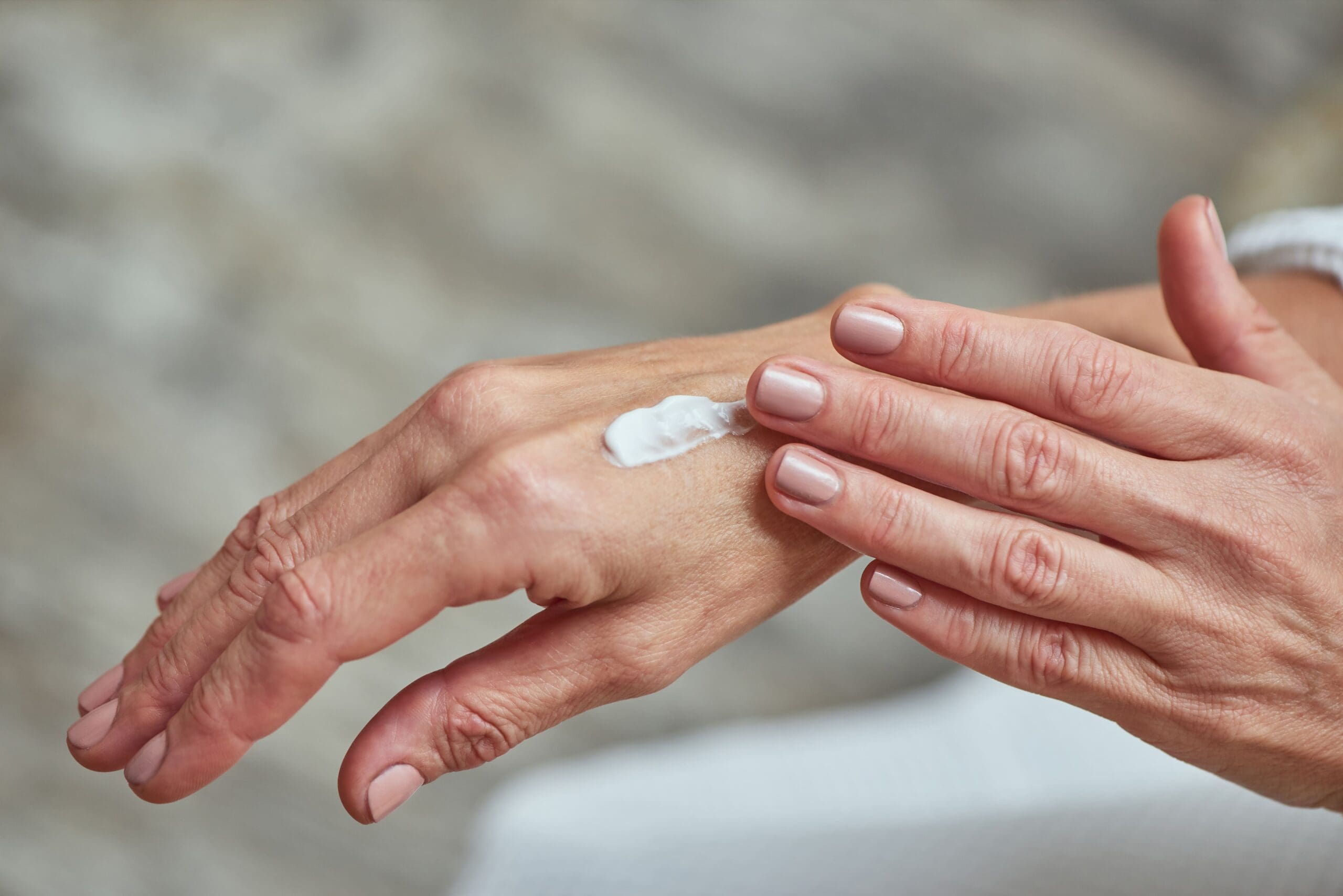 Resequedad en las manos: cómo tratarla y prevenirla